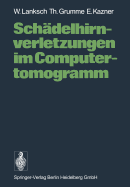 Schadelhirnverletzungen Im Computertomogramm