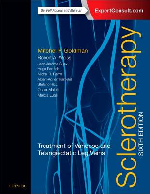 Sclerotherapy: Treatment of Varicose and Telangiectatic Leg Veins - Goldman, Mitchel P, MD, and Weiss, Robert A, MD