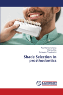 Shade Selection In prosthodontics