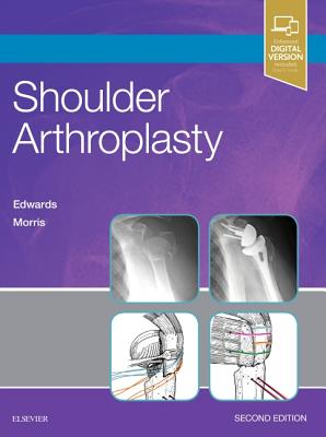 Shoulder Arthroplasty - Edwards, T Bradley, MD, and Morris, Brent J, MD