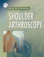 Shoulder Arthroscopy