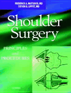 Shoulder Surgery: Principles and Procedures