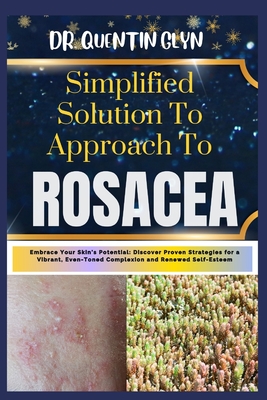 Simplified Solution Approach To ROSACEA: Embrace Your Skin's Potential: Discover Proven Strategies for a Vibrant, Even-Toned Complexion and Renewed Self-Esteem - Glyn, Quentin, Dr.