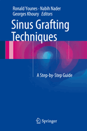 Sinus Grafting Techniques: A Step-By-Step Guide