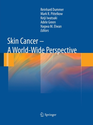 Skin Cancer - A World-Wide Perspective - Dummer, Reinhard (Editor), and Pittelkow, Mark R (Editor), and Iwatsuki, Keiji (Editor)