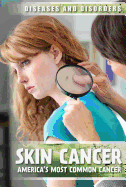 Skin Cancer: America's Most Common Cancer