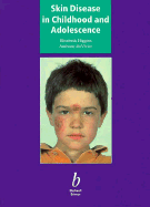 Skin disease in childhood and adolescence