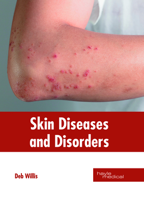 Skin Diseases and Disorders - Willis, Deb (Editor)