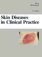 Skin Diseases in Clinical Practice - Bork, Konrad, MD, and Brauninger, Wolfgang, MD