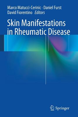 Skin Manifestations in Rheumatic Disease - Matucci-Cerinic, Marco (Editor), and Furst, Daniel (Editor), and Fiorentino, David (Editor)