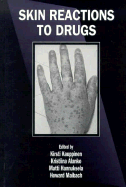 Skin Reactions to Drugs