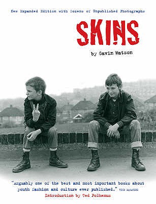 Skins - Watson, Gavin