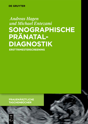 Sonographische Pr?nataldiagnostik - Hagen, Andreas, and Entezami, Michael