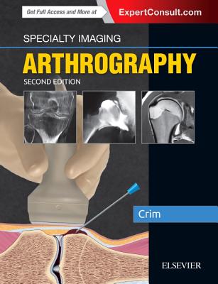 Specialty Imaging: Arthrography - Crim, Julia R, MD