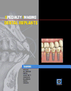 Specialty Imaging: Dental Implants