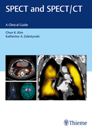 Spect and Spect/CT: A Clinical Guide