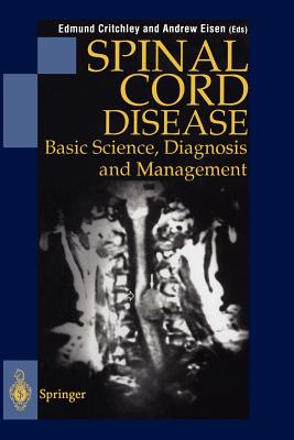 Spinal Cord Disease: Basic Science, Diagnosis and Management - Critchley, Edmund (Editor), and Eisen, Andrew A (Editor)