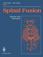 Spinal fusion science and technique