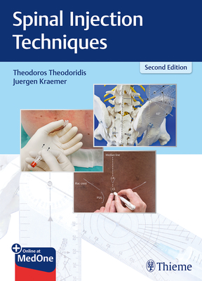 Spinal Injection Techniques - Theodoridis, Theodoros (Editor), and Krmer, Jrgen (Editor)