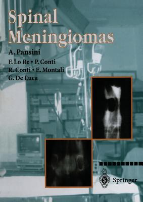 Spinal Meningiomas - Pansini, A, and Lo Re, F, and Conti, P