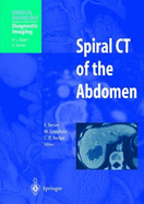 Spiral CT of the Abdomen