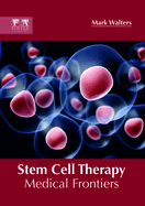 Stem Cell Therapy: Medical Frontiers