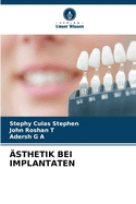 ?sthetik Bei Implantaten