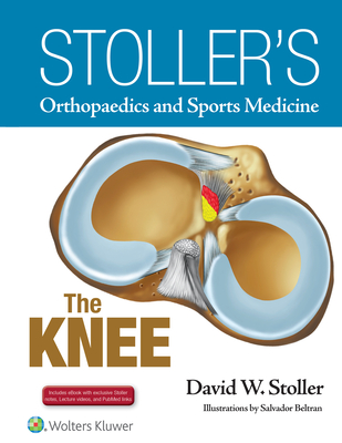 Stoller's Orthopaedics and Sports Medicine: The Knee: Includes Stoller Lecture Videos and Stoller Notes - Stoller, David W, MD, Facr