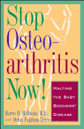 Stop Osteoarthritis Now!: Halting the Baby Boomers' Disease