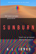 Sunburn