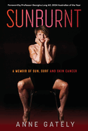 Sunburnt: A memoir of sun, surf and skin cancer