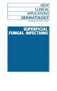 Superficial Fungal Infections