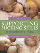 Supporting Sucking Skills in Breastfeeding Infants (Revised)