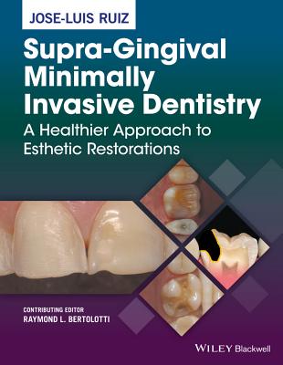 Supra-Gingival Minimally Invasive Dentistry: A Healthier Approach to Esthetic Restorations - Ruiz, Jose-Luis