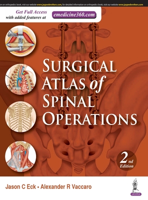 Surgical Atlas of Spinal Operations - Eck, Jason, and Vaccaro, Alexander R