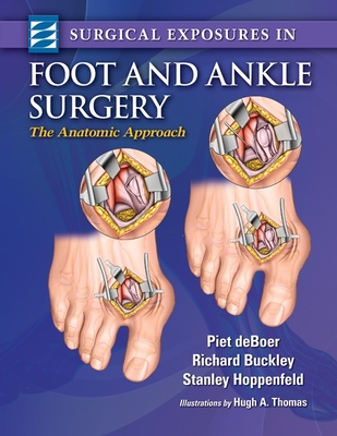 Surgical Exposures in Foot & Ankle Surgery: The Anatomic Approach - DeBoer, Piet, Ma, Frcs, and Buckley, Richard, MD, and Hoppenfeld, Stanley, MD