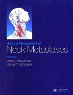 Surgical Management of Neck Metastases