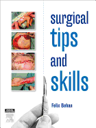 Surgical Tips and Skills