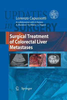 Surgical Treatment of Colorectal Liver Metastases - Capussotti, Lorenzo (Editor)