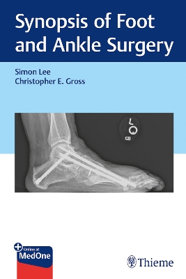 Synopsis of Foot and Ankle Surgery - Lee, Simon, and Gross, Christopher