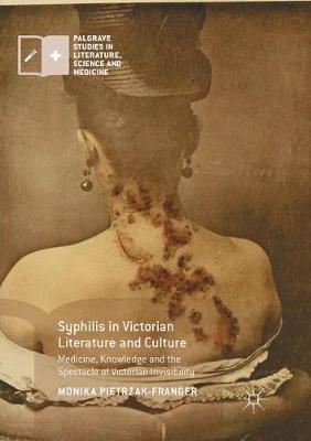 Syphilis in Victorian Literature and Culture: Medicine, Knowledge and the Spectacle of Victorian Invisibility - Pietrzak-Franger, Monika