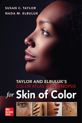 Taylor and Elbuluk's Color Atlas and Synopsis for Skin of Color - Taylor, Susan, and Elbuluk, Nada