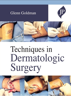 Techniques in Dermatologic Surgery - Goldman, Glenn