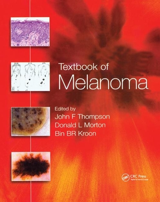 Textbook of Melanoma: Pathology, Diagnosis and Management - Thompson, John F. (Editor), and Morton, Donald L. (Editor), and Kroon, Bin B.R. (Editor)