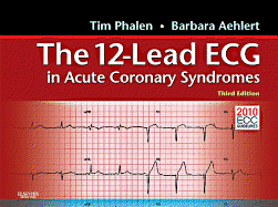 The 12-Lead ECG in Acute Coronary Syndromes: Pocket Reference for the 12-Lead ECG in Acute Coronary Syndromes