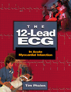 The 12-Lead ECG in Acute Myocardial Infarction - Phalen, Tim