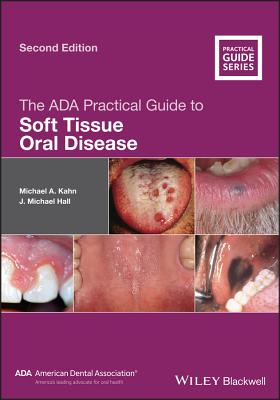 The ADA Practical Guide to Soft Tissue Oral Disease - Kahn, Michael A., and Hall, J. Michael