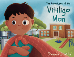 The Adventures of The Vitiligo Man