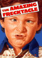 The Amazing Frecktacle