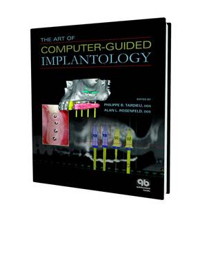 The Art of Computer-Guided Implantology - Tardieu, Philippe B (Editor), and Rosenfeld, Alan L (Editor)
